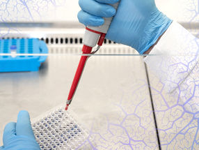 SynaptixBio select candidate drug for clinical trials