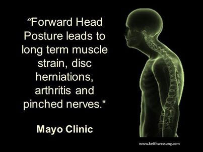 Neck Pain and Herniated Discs
