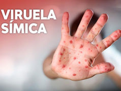 SESA REALIZA ACCIONES DE VIGILANCIA EPIDEMIOLÓGICA CON RELACIÓN A LA VIRUELA SÍMICA.
