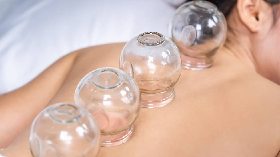 The Plaza Kansas City cupping therapy,
