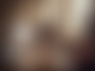 Kaplan–Meier Curves Explained for MRCP Part 1 