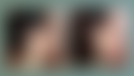 Top 3 Tips for Healthy, Radiant Skin: HowCosmetic Acupuncture Can Combat Aging