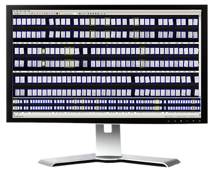 Ribbon Scanning of microfilm
