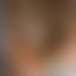 Pourquoi vos cheveux deviennent-ils plus fins en été ?Le secret enfin dévoilé