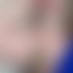 Détoxifiez, Purifiez et Protégez Naturellement vos Aisselles🌿