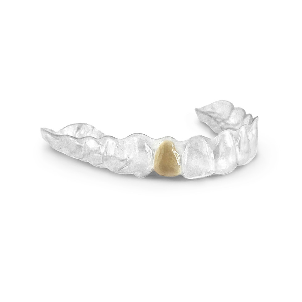 Thumbnail: Aligner Zendura FLX 0.76mm