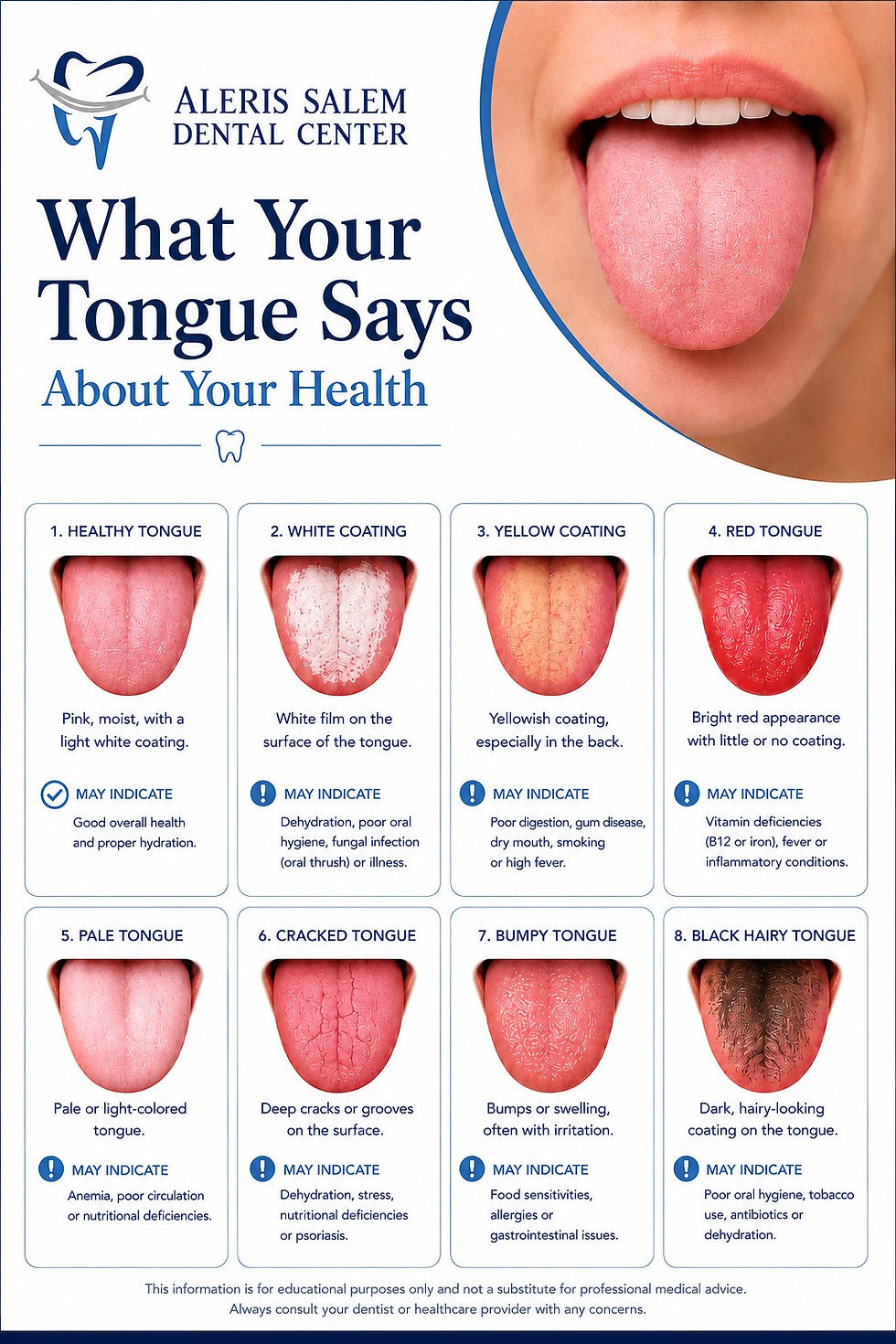 Infographic showing tongue color and texture changes and what they may indicate about overall health and oral wellness.