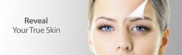 Reveal-true-skin-chemical-peel-Malta-CHIC.jpg