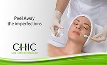Chemical-Peel-Malta-CHIC-x.jpg