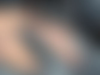 Understanding the Potential Regrets of Scalp Micropigmentation (SMP) in Orlando