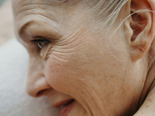 Woman with signs of aging