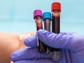 When Should You Do a Health Screening?