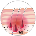 ハイパワーSHR脱毛