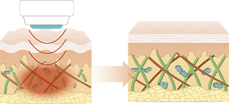 rf.png