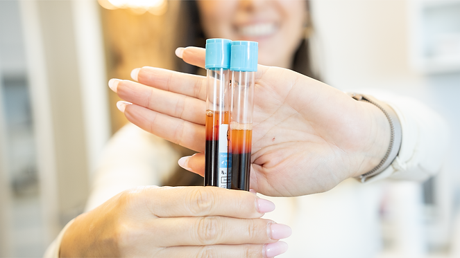 Viles of plasma for skin treatments