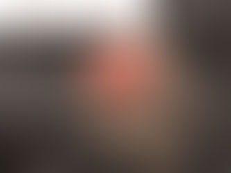 軟性線維腫 第2報