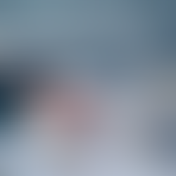 Occuity Partners with Indo Optical as Exclusive Distributor of PM1 Pachymeter