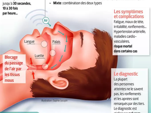 Apnées du sommeil : les patients sous PPC inobservants bientôt désappareillés ?