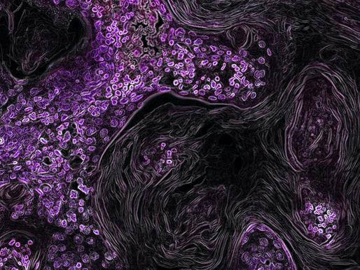 Des avancées dans la recherche sur le cancer, malgré la pandémie
