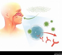 Les allergies cutanées et respiratoires précoces sont prédictives des allergies alimentaires
