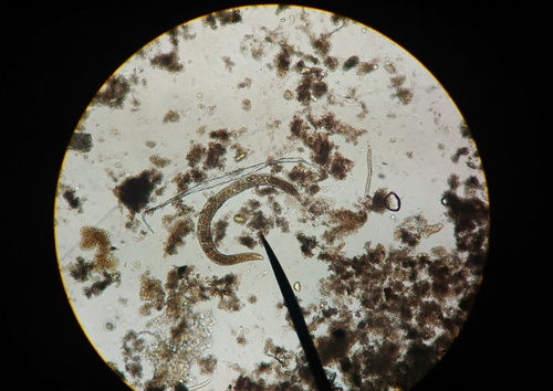 Alles hat ein Ende nur der Wurm hat zwei