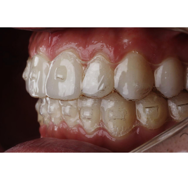 Post de Instagram estimulação de colágeno carrossel elegante preto.png