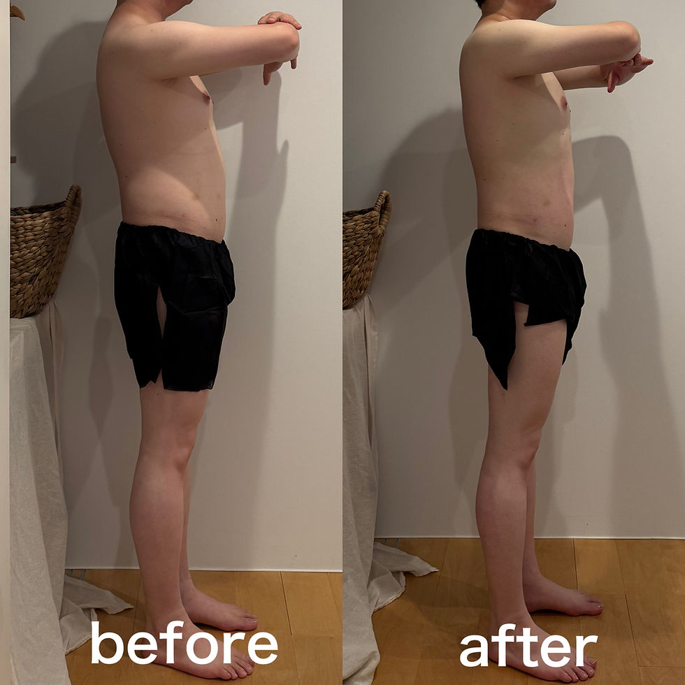 男性のお客様の背中側から見た施術前後の比較。肩や腰まわりのハリがやわらぎ、背中全体がなめらかに整った様子。