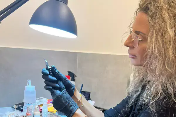 העלמת סימני מתיחה