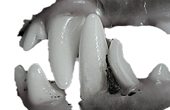 retained-teeth-2_edited.png