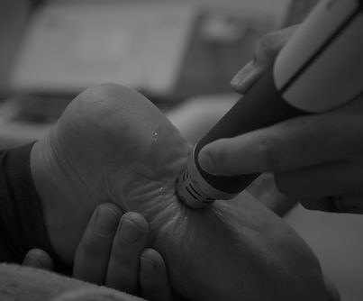 plantar-fascitis (1).jpeg