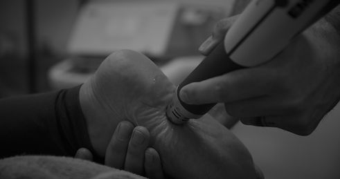 shockwave for plantar fasciits in West Auckland