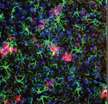 Microglia_plaques_Astrocytes_SNLab.png