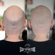 tetovanie vlasov hair tattoo smp mikropigmentácia