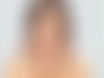 Como controlar o Melasma?