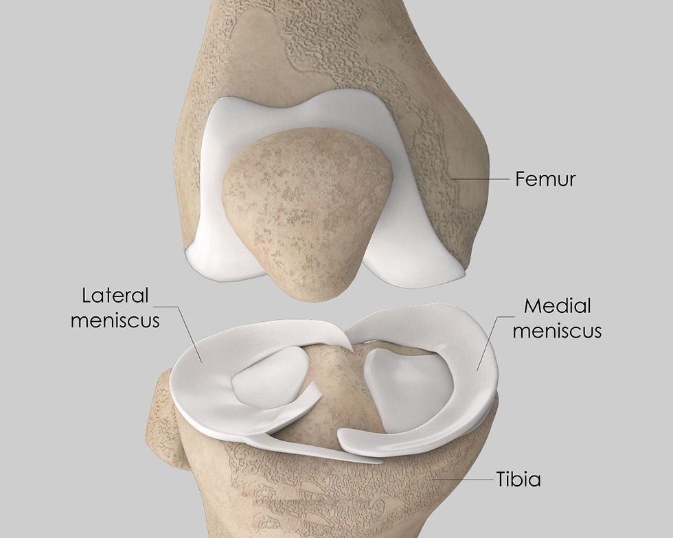 Knee meniscus tear