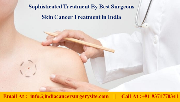 Sophisticated Treatment By Best Surgeons Skin Cancer Treatment in India