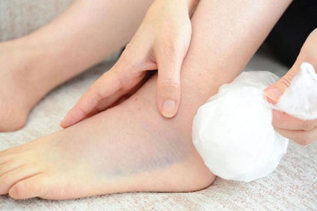 Vật lý trị liệu viêm khớp cổ chân