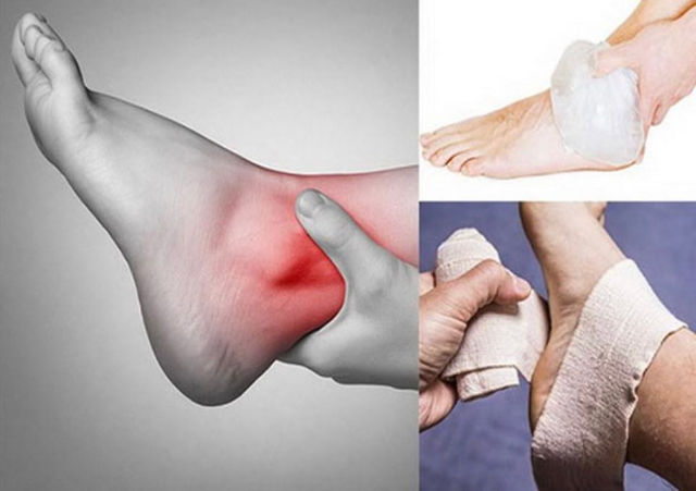 Chấn thương khớp cổ chân gây thoái hóa