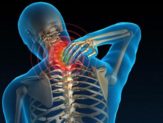 Thoái hóa cột sống cổ: nguyên nhân, triệu chứng và cách điều trị