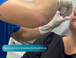 Aplicación de botox en bogotá