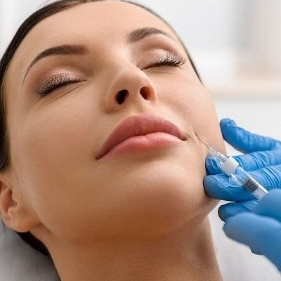 Radiesse Filler Injections