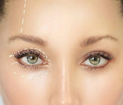Latest Trends in Eyelid Surgery for 2026