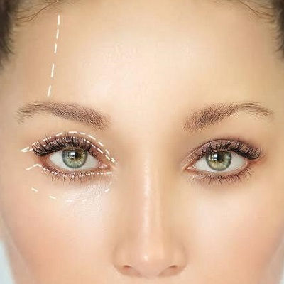 Latest Trends in Eyelid Surgery for 2026
