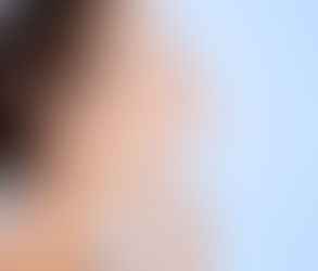 Chin Liposuction Before and After: Realistic Expectations