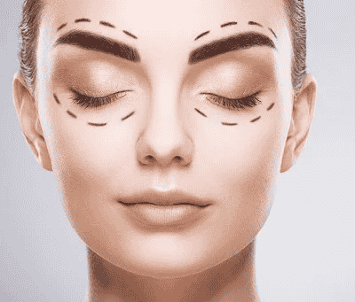 Eyelid Surgery Recovery: Tips for Faster Healing