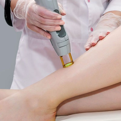 What Happens During Laser Hair Removal Sessions?