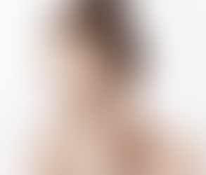 Top Jawline Treatments for Sagging Skin and Jowls