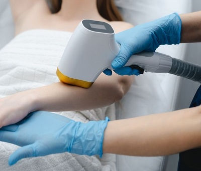 Laser Hair Removal for Arms: Beginner’s Guide