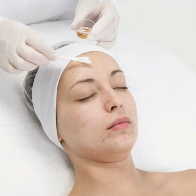 Dermamelan Treatment in Oman