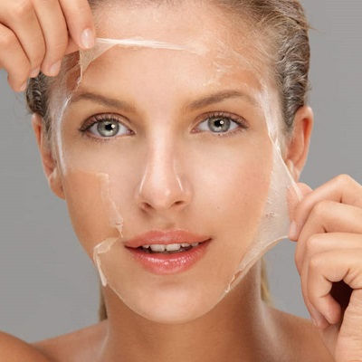 Chemical Peels